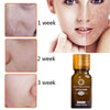 Acne Stretch Marks Scar Removal Essence oil